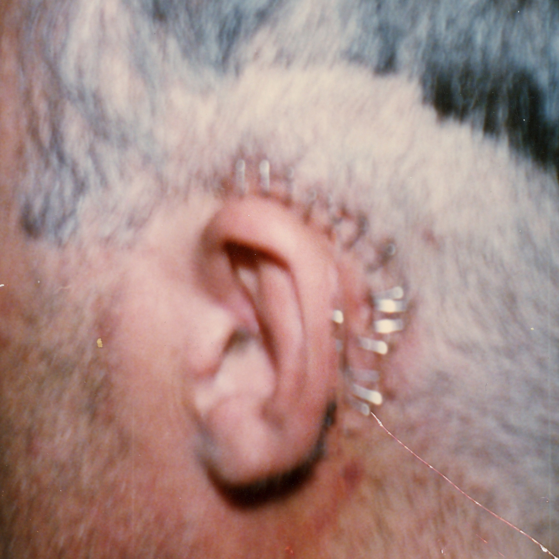 kirk miller surgery portrait